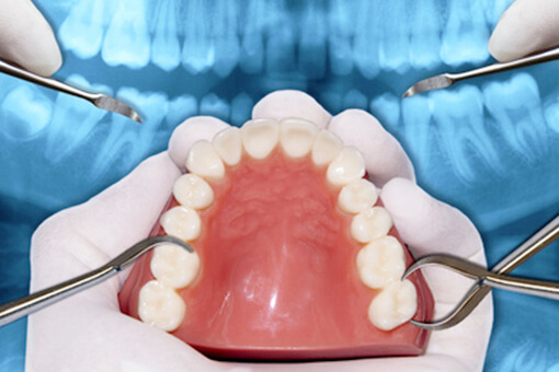 入れ歯のメンテナンス