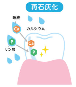 歯の再石灰化