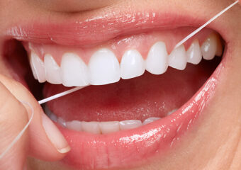 デンタルフロス習慣