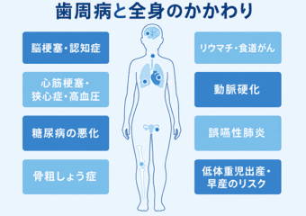 歯周病と全身のかかわり